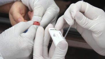 Teste_coronavirus